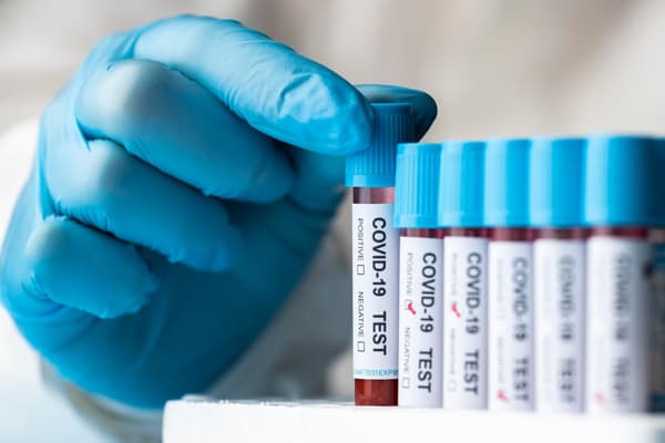 blood-test